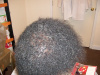Case #2 5 Months