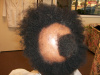 Case #2 Before