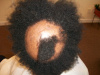 Case #2 Before
