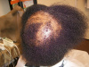 Case #2 Progression