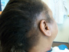 Case #3 Progression