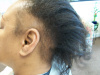Case #3 Progression