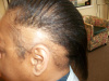 Case #3 Before