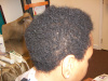 Case #1 After